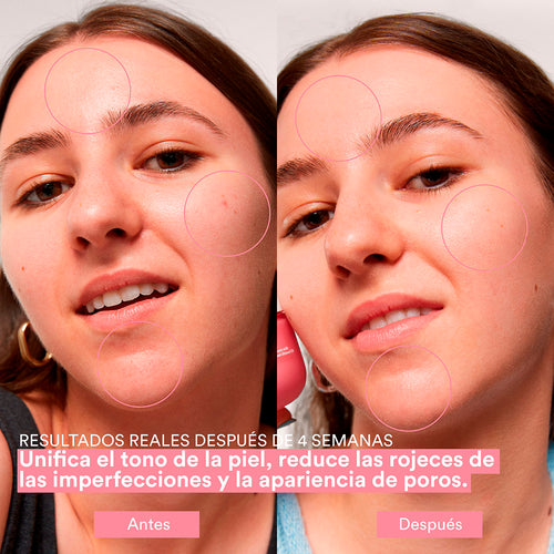 Cargar la imagen 1 en la vista de la galería